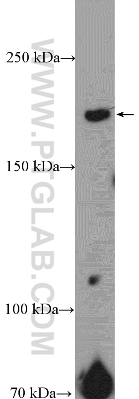 Western Blot (WB) analysis of mouse testis tissue using SHPRH Polyclonal antibody (21955-1-AP)