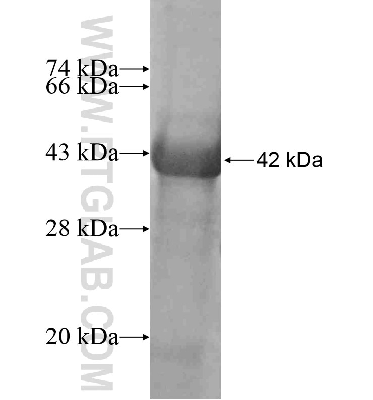 SHPRH fusion protein Ag16580 SDS-PAGE