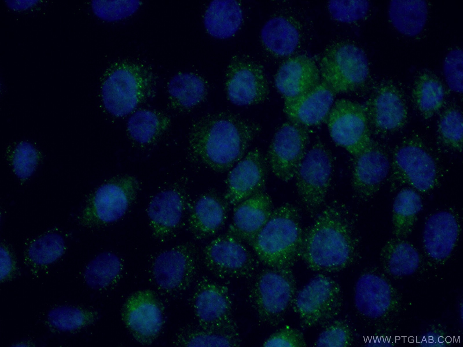 Immunofluorescence (IF) / fluorescent staining of A431 cells using SHQ1 Polyclonal antibody (27020-1-AP)