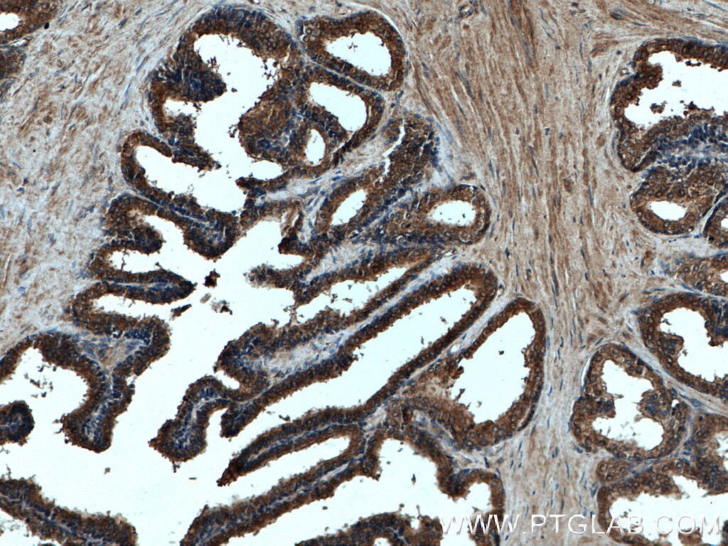 Immunohistochemistry (IHC) staining of human prostate hyperplasia tissue using SHQ1 Polyclonal antibody (27020-1-AP)