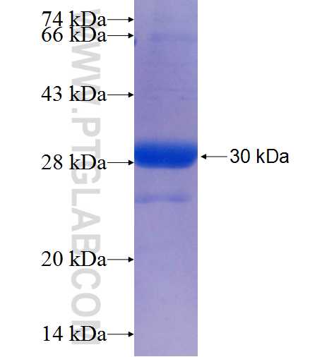 SHQ1 fusion protein Ag25559 SDS-PAGE
