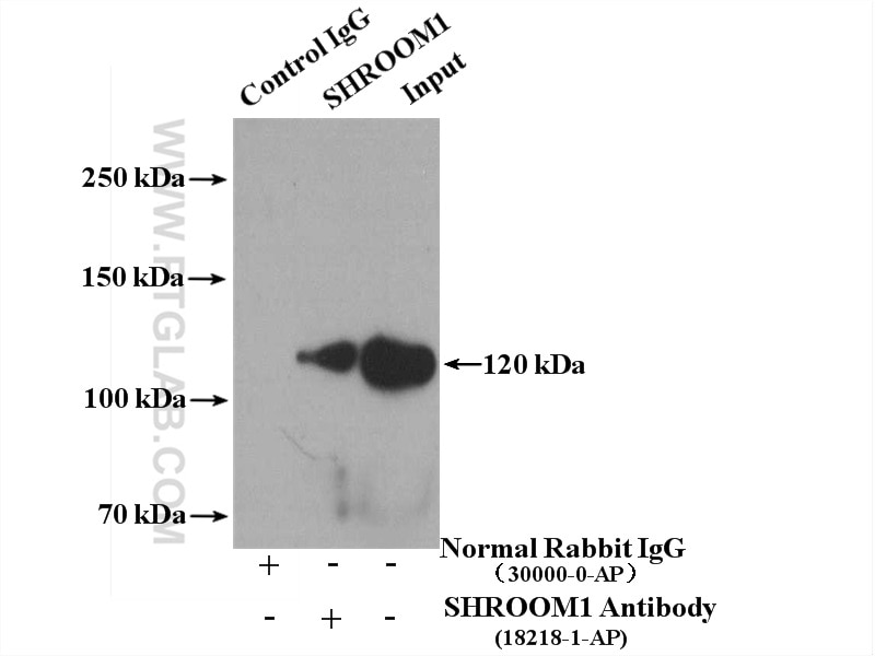 Immunoprecipitation (IP) experiment of MCF-7 cells using SHROOM1 Polyclonal antibody (18218-1-AP)