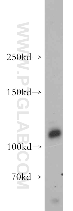 Western Blot (WB) analysis of MCF-7 cells using SHROOM1 Polyclonal antibody (18218-1-AP)