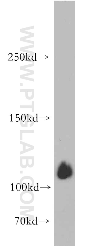 Western Blot (WB) analysis of A375 cells using SHROOM1 Polyclonal antibody (18218-1-AP)