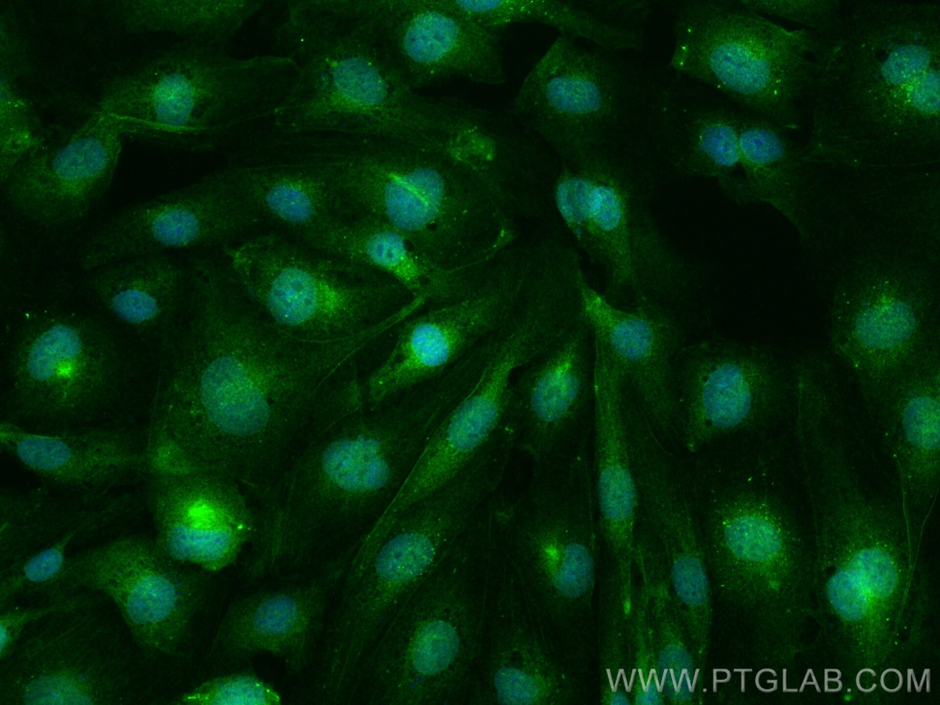 IF Staining of HUVEC using 31712-1-AP Immunofluorescence (IF) / fluorescent staining of HUVEC cells using SHROOM4 Polyclonal antibody (31712-1-AP)