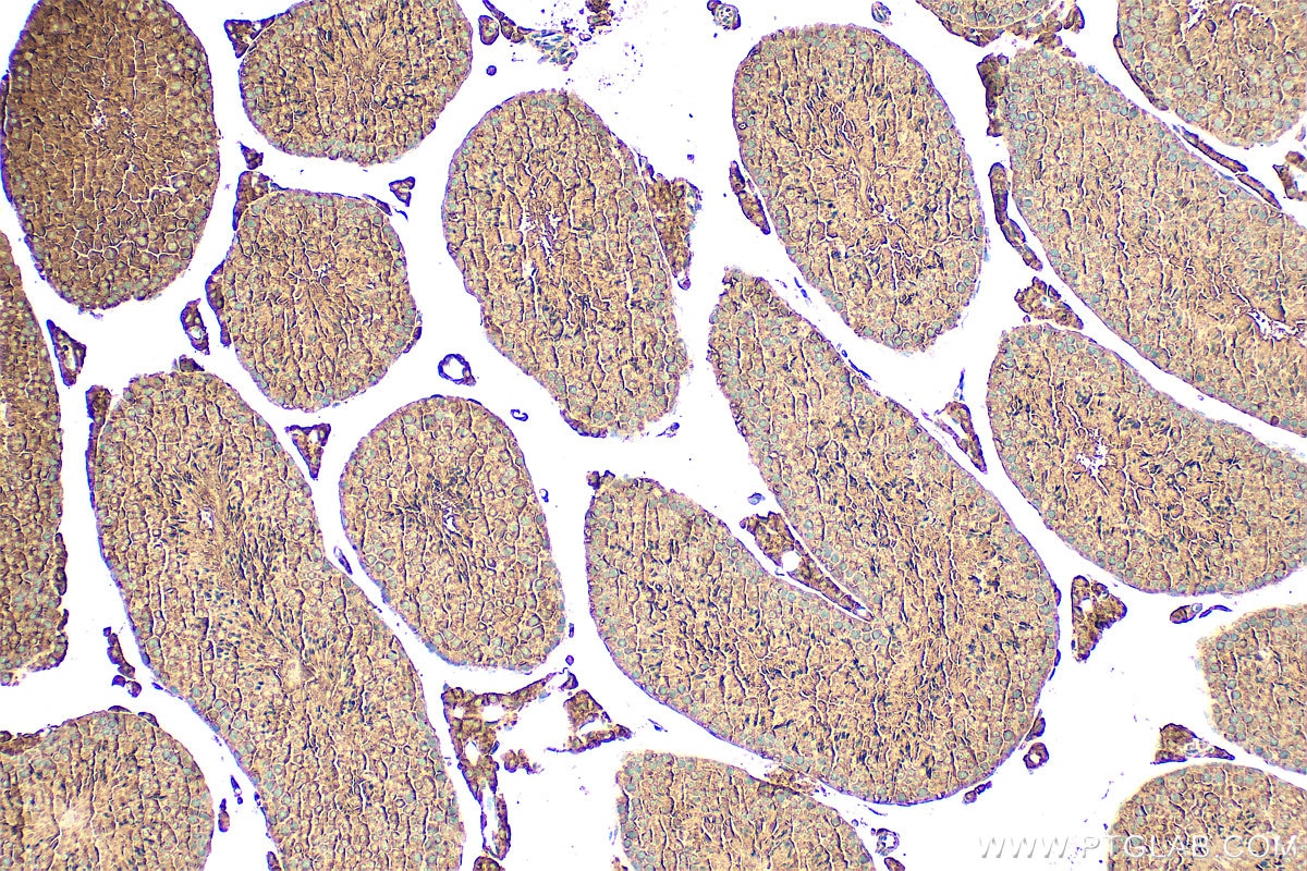 IHC staining of mouse testis using 31712-1-AP Immunohistochemistry (IHC) staining of mouse testis tissue using SHROOM4 Polyclonal antibody (31712-1-AP)