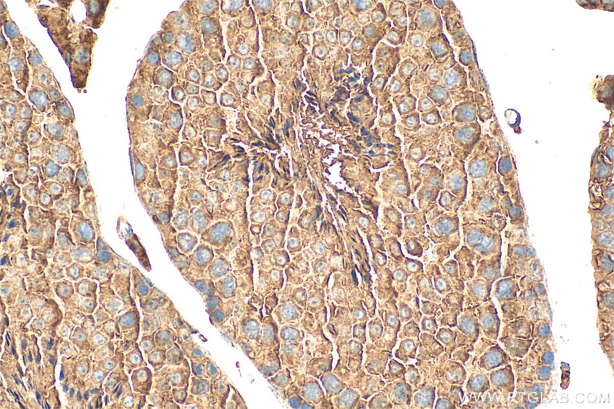 IHC staining of mouse testis using 31712-1-AP Immunohistochemistry (IHC) staining of mouse testis tissue using SHROOM4 Polyclonal antibody (31712-1-AP)