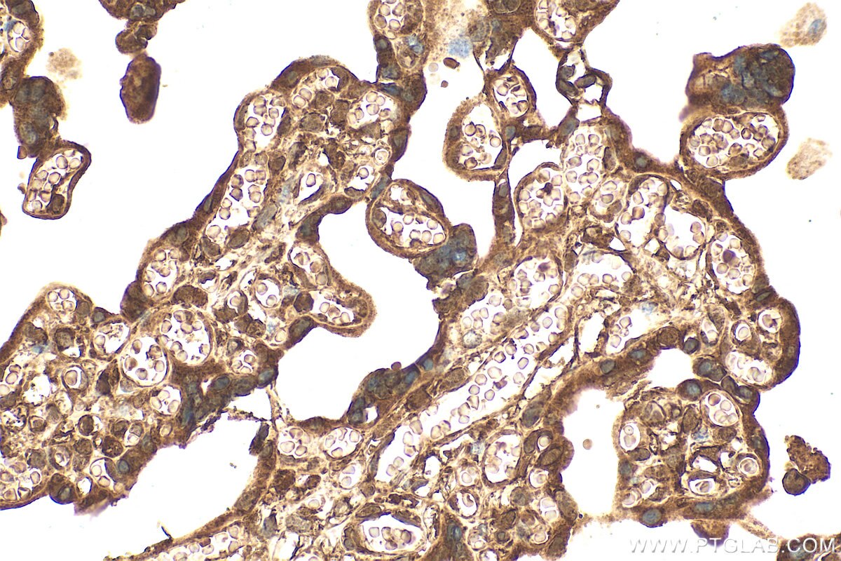 IHC staining of human placenta using 31712-1-AP Immunohistochemistry (IHC) staining of human placenta tissue using SHROOM4 Polyclonal antibody (31712-1-AP)