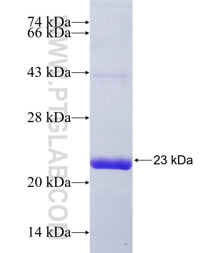 SHROOM4 fusion protein Ag36423 SDS-PAGE SHROOM4 fusion protein Ag36423 SDS-PAGE