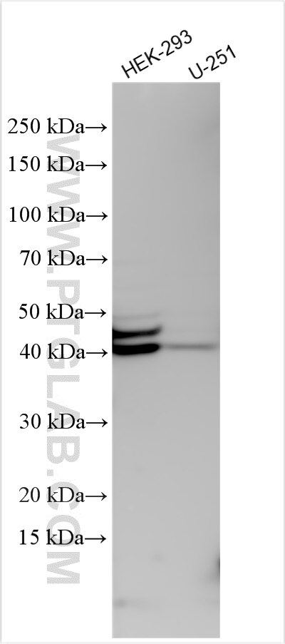 Western Blot (WB) analysis of various lysates using SI-CLP,CHID1 Polyclonal antibody (19900-1-AP)