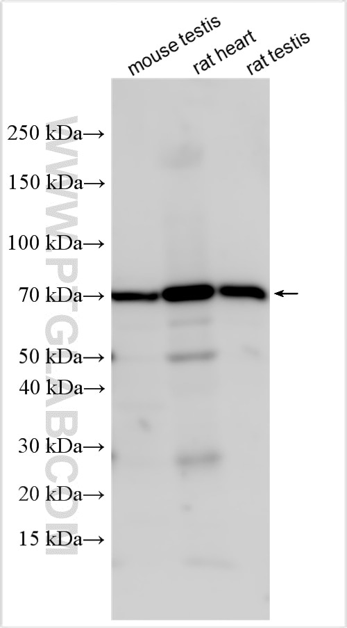 Western Blot (WB) analysis of various lysates using SIAE Polyclonal antibody (14566-1-AP)