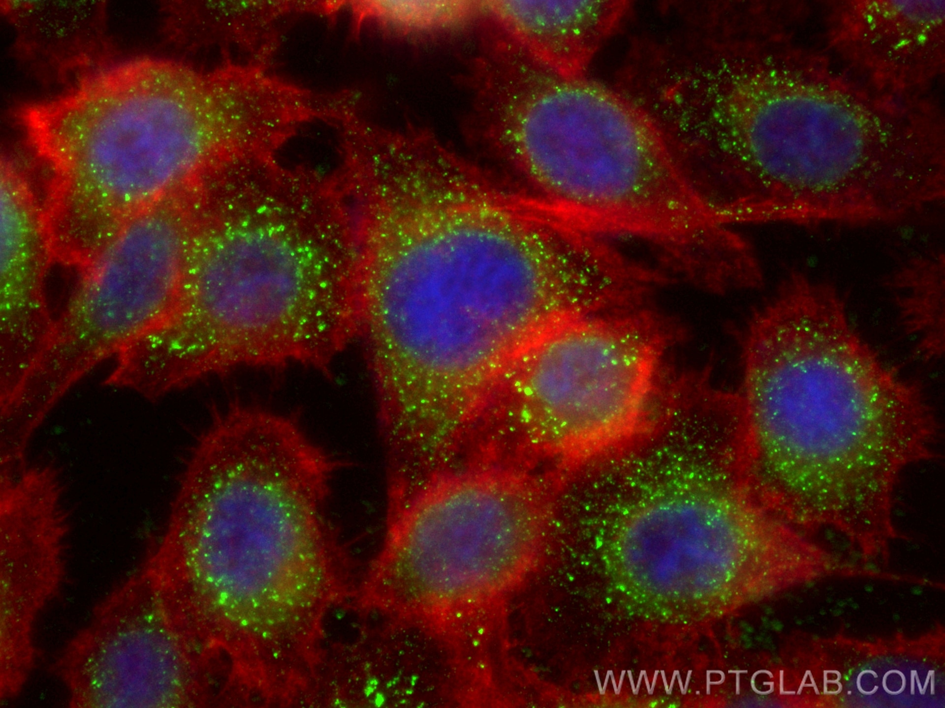 Immunofluorescence (IF) / fluorescent staining of PC-3 cells using SIAE Monoclonal antibody (66522-1-Ig)
