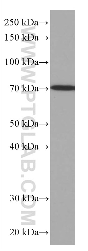 Western Blot (WB) analysis of pig liver tissue using SIAE Monoclonal antibody (66522-1-Ig)