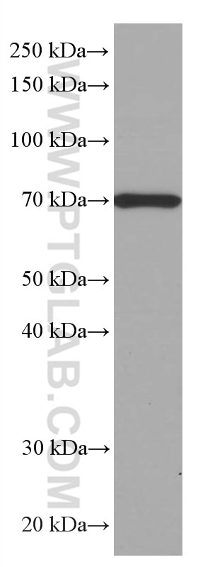 Western Blot (WB) analysis of pig colon tissue using SIAE Monoclonal antibody (66522-1-Ig)