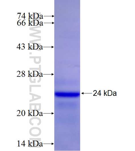 SIAE fusion protein Ag26997 SDS-PAGE