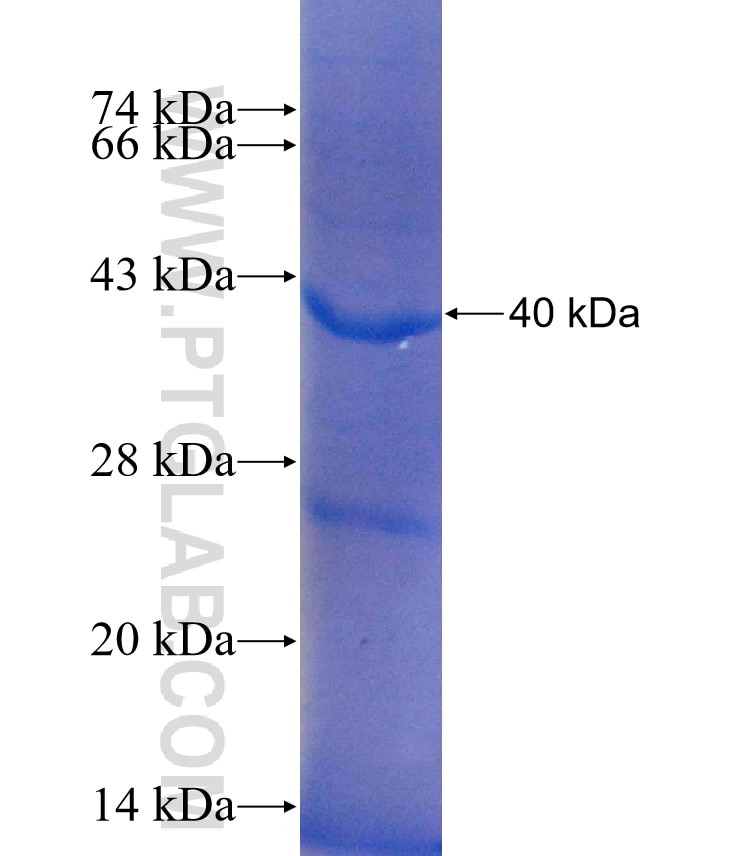 SIAE fusion protein Ag14624 SDS-PAGE