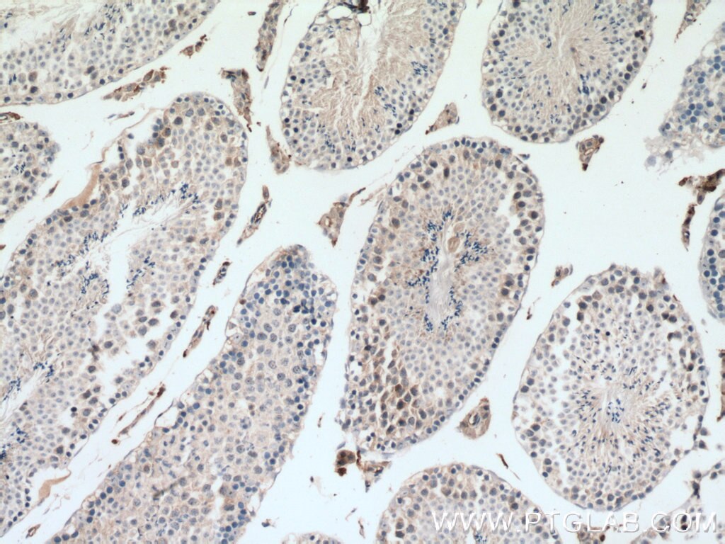 IHC staining of mouse testis using 13886-1-AP