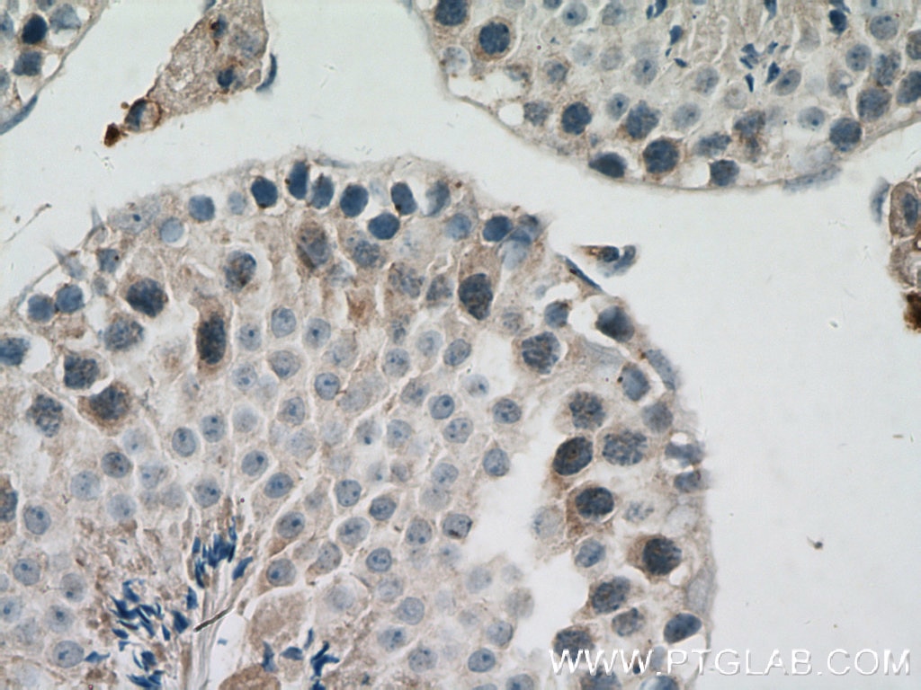 IHC staining of mouse testis using 13886-1-AP