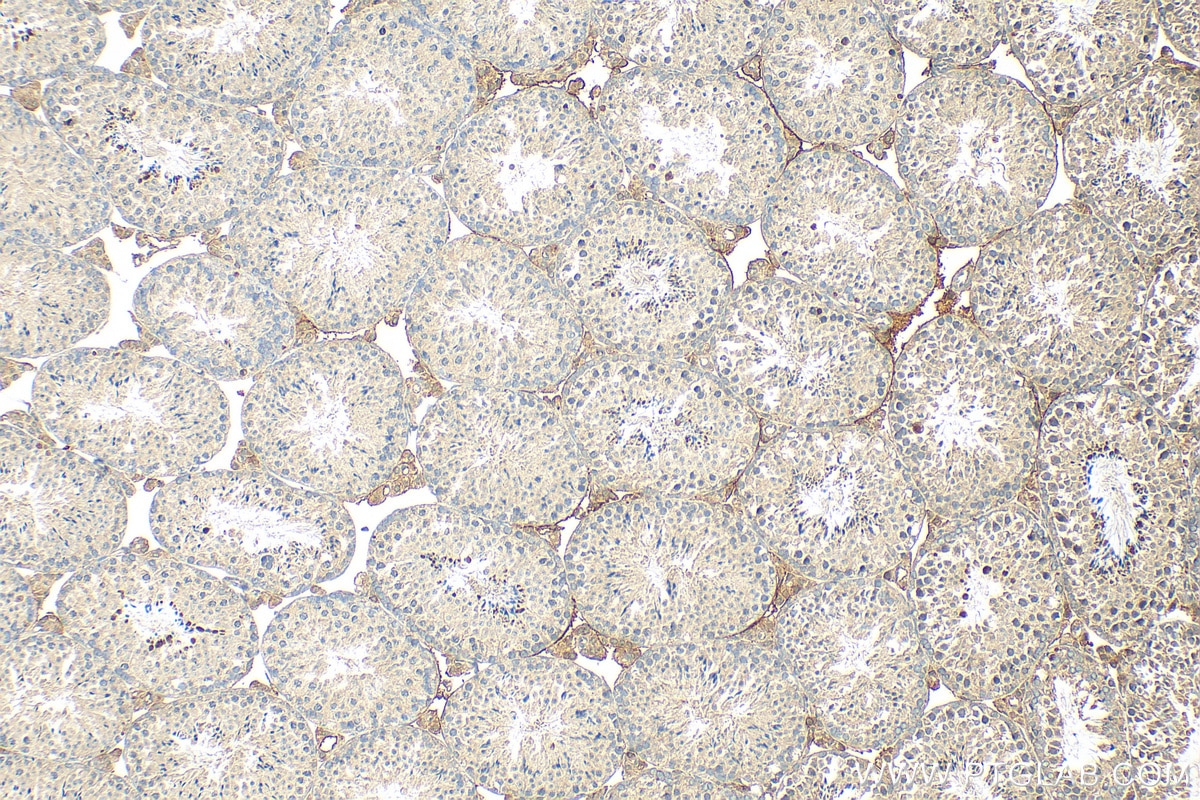 Immunohistochemistry (IHC) staining of mouse testis tissue using SIAH1 Polyclonal antibody (13886-1-AP)