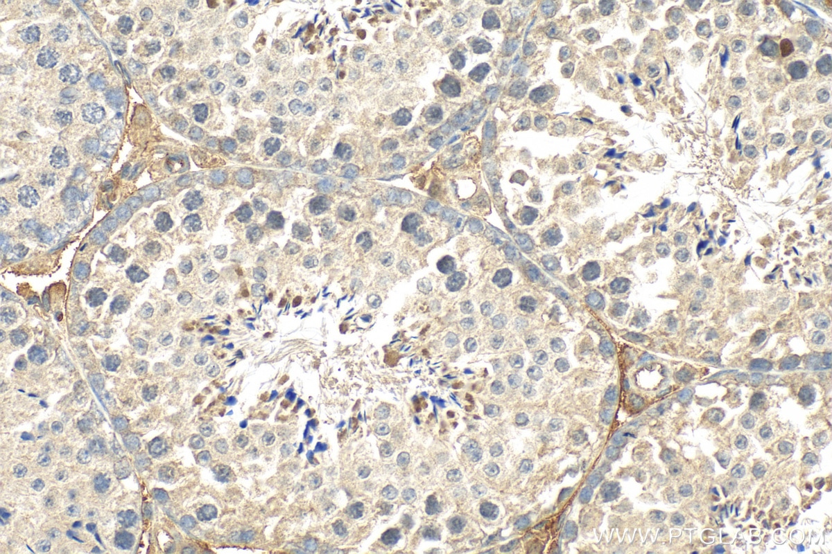 Immunohistochemistry (IHC) staining of mouse testis tissue using SIAH1 Polyclonal antibody (13886-1-AP)