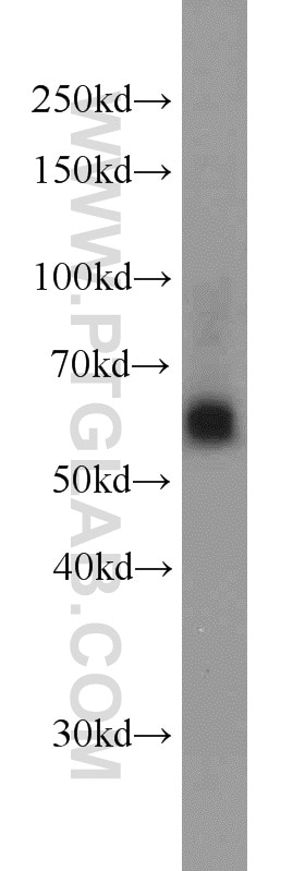 WB analysis of HeLa using 13886-1-AP