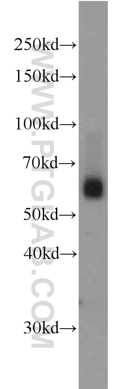 Western Blot (WB) analysis of A549 cells using SIAH1 Polyclonal antibody (13886-1-AP)