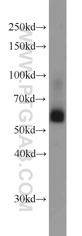 Western Blot (WB) analysis of Jurkat cells using SIAH1 Polyclonal antibody (13886-1-AP)