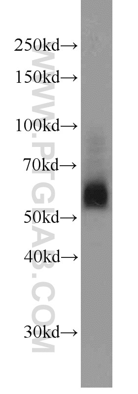 Western Blot (WB) analysis of RAW264.7 using SIAH1 Polyclonal antibody (13886-1-AP)