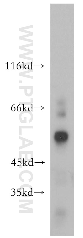 Western Blot (WB) analysis of mouse small intestine tissue using SIAH1 Polyclonal antibody (13886-1-AP)