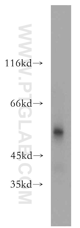 Western Blot (WB) analysis of HeLa cells using SIAH1 Polyclonal antibody (13886-1-AP)