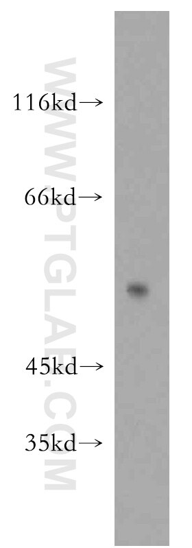 Western Blot (WB) analysis of COLO 320 cells using SIAH1 Polyclonal antibody (13886-1-AP)