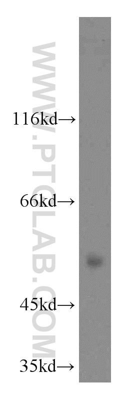 Western Blot (WB) analysis of HepG2 cells using SIAH1 Polyclonal antibody (13886-1-AP)