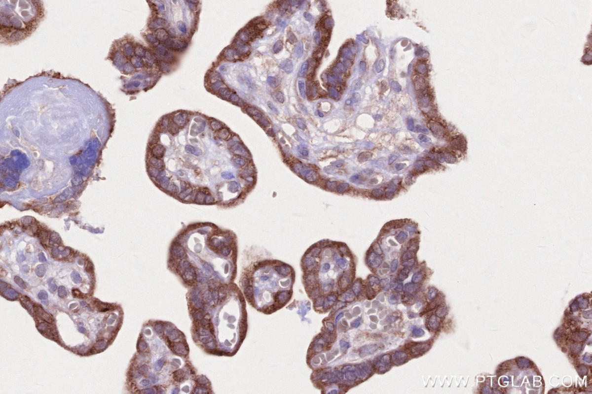 Immunohistochemistry (IHC) staining of human placenta tissue using SIAH1 Recombinant monoclonal antibody (83389-4-RR)