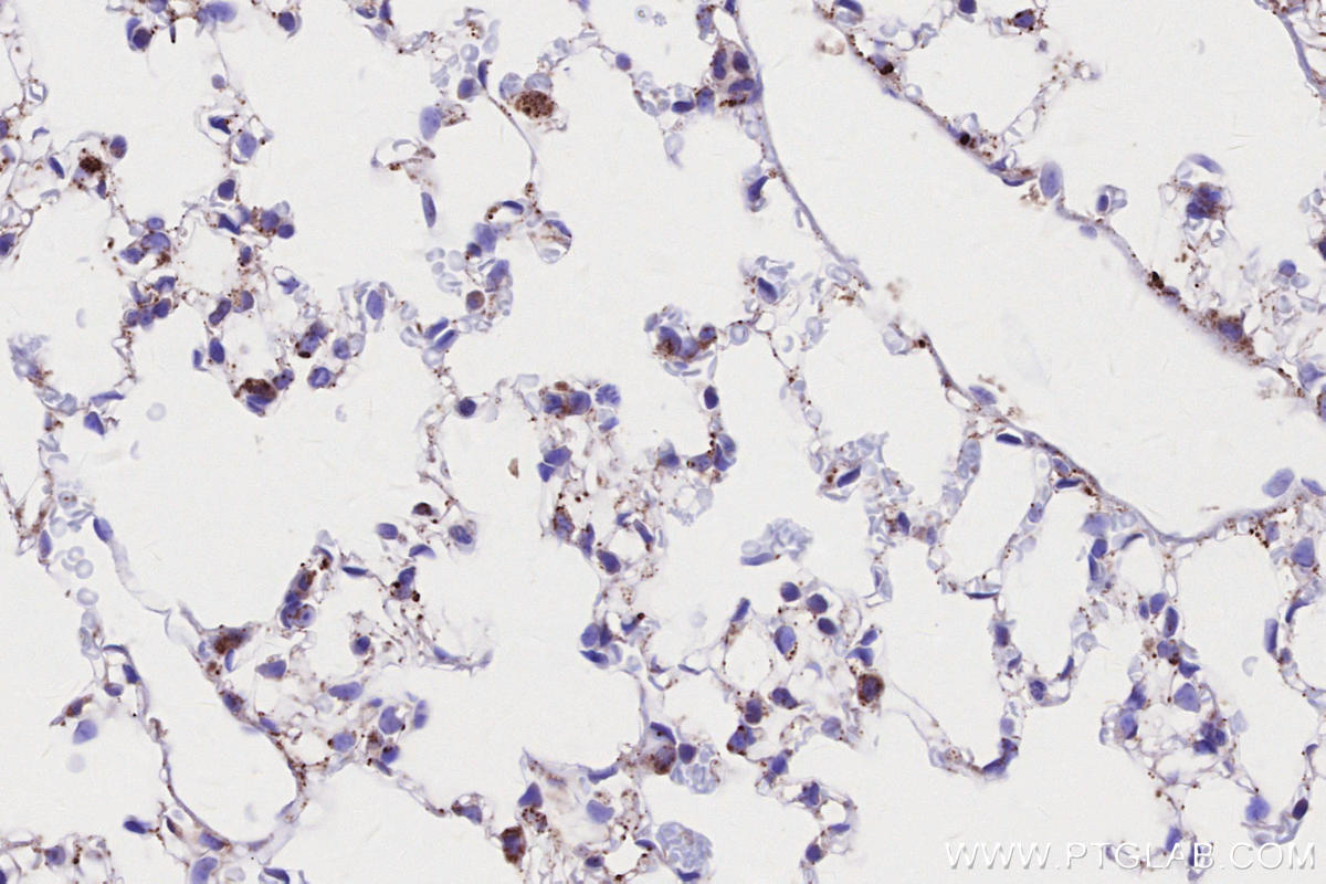Immunohistochemistry (IHC) staining of mouse lung tissue using SIAH1 Recombinant monoclonal antibody (83389-4-RR)