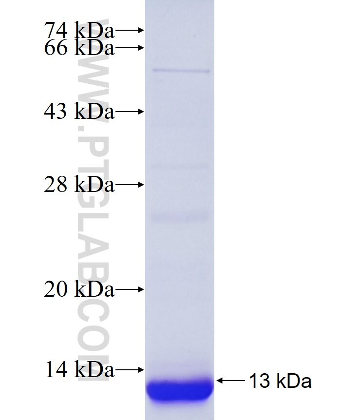 SIAH1 fusion protein Ag34187 SDS-PAGE SIAH1 fusion protein Ag34187 SDS-PAGE