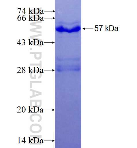SIAH1 fusion protein Ag4336 SDS-PAGE