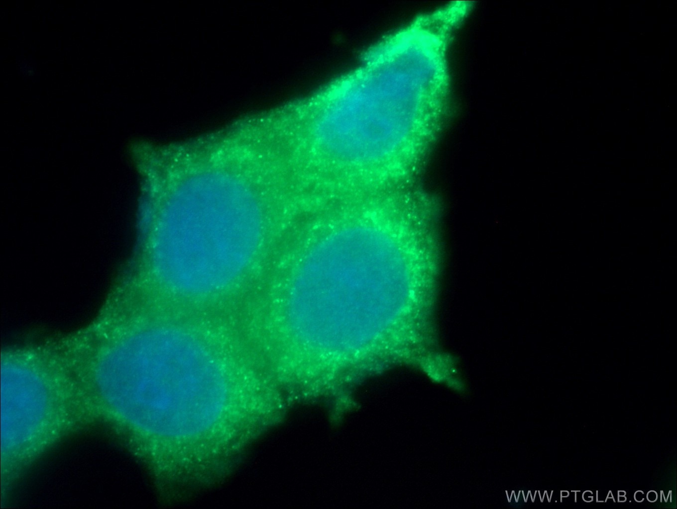 Immunofluorescence (IF) / fluorescent staining of MCF-7 cells using SIAH2 Polyclonal antibody (12651-1-AP)