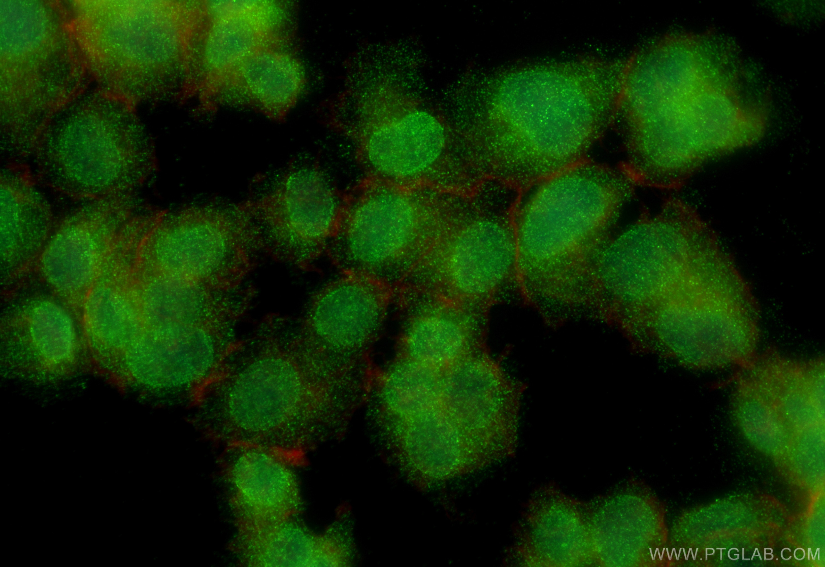 Immunofluorescence (IF) / fluorescent staining of PC-12 cells using SIAH2 Polyclonal antibody (12651-1-AP)