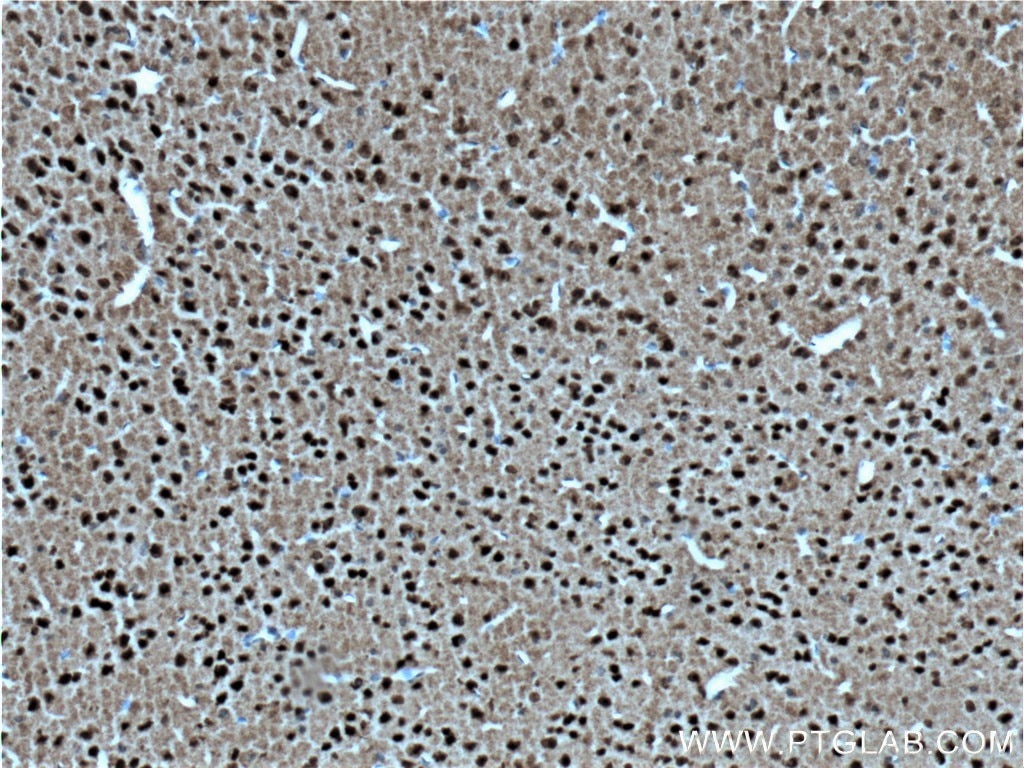 Immunohistochemistry (IHC) staining of mouse brain tissue using SIAH2 Polyclonal antibody (12651-1-AP)