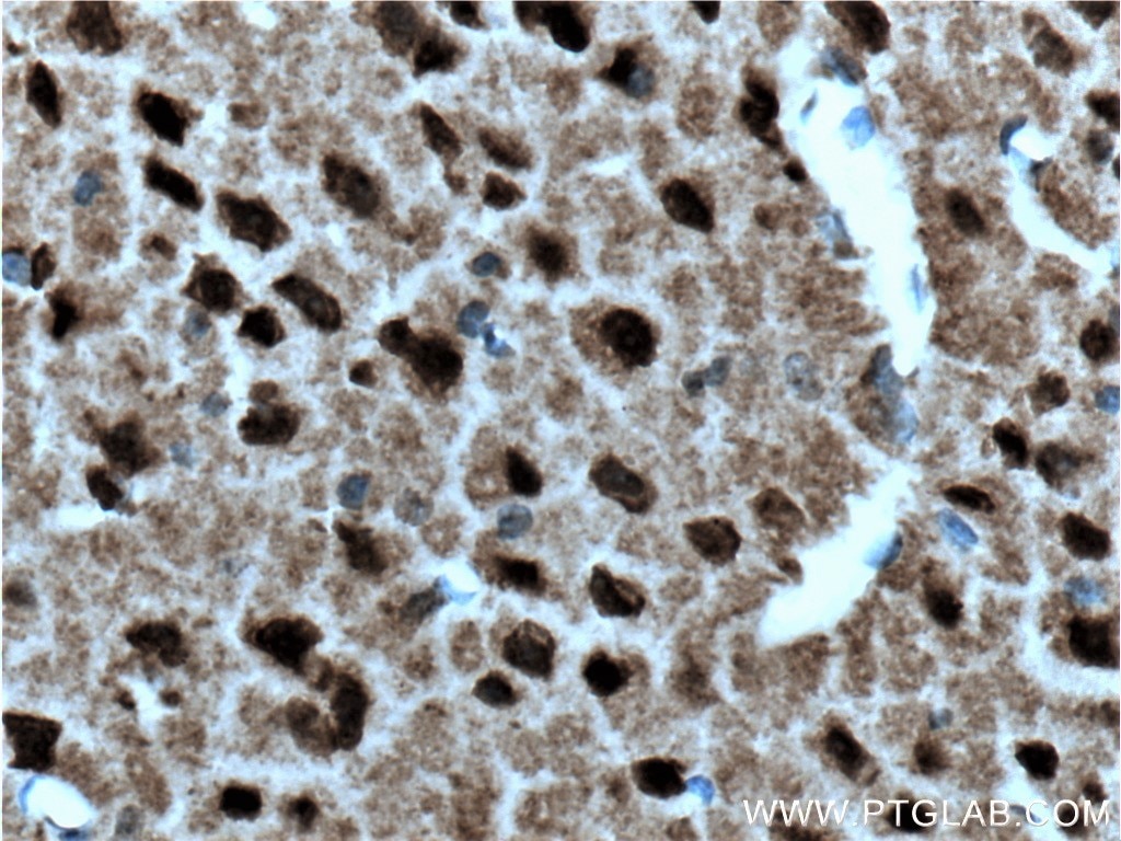Immunohistochemistry (IHC) staining of mouse brain tissue using SIAH2 Polyclonal antibody (12651-1-AP)