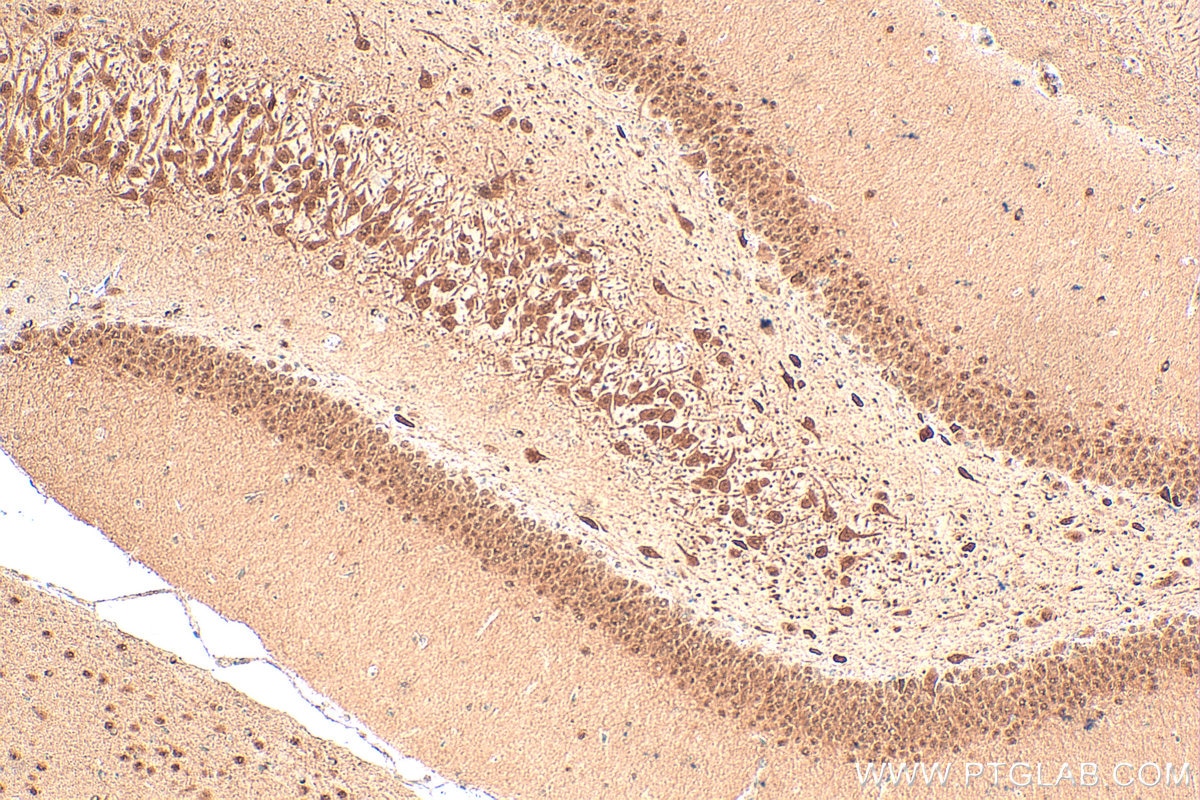 Immunohistochemical analysis of paraffin-embedded rat brain tissue slide using 12651-1-AP (SIAH2 antibody) at dilution of 1:100 (under 10x lens). Heat mediated antigen retrieval with Tris-EDTA buffer (pH 9.0). Immunohistochemistry (IHC) staining of rat brain tissue using SIAH2 Polyclonal antibody (12651-1-AP)
