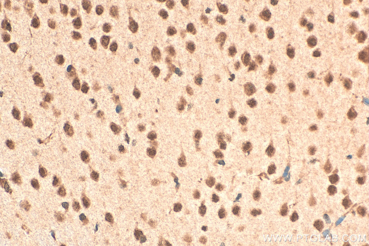 Immunohistochemical analysis of paraffin-embedded mouse brain tissue slide using 12651-1-AP (SIAH2 antibody) at dilution of 1:100 (under 40x lens). Heat mediated antigen retrieval with Tris-EDTA buffer (pH 9.0). Immunohistochemistry (IHC) staining of mouse brain tissue using SIAH2 Polyclonal antibody (12651-1-AP)
