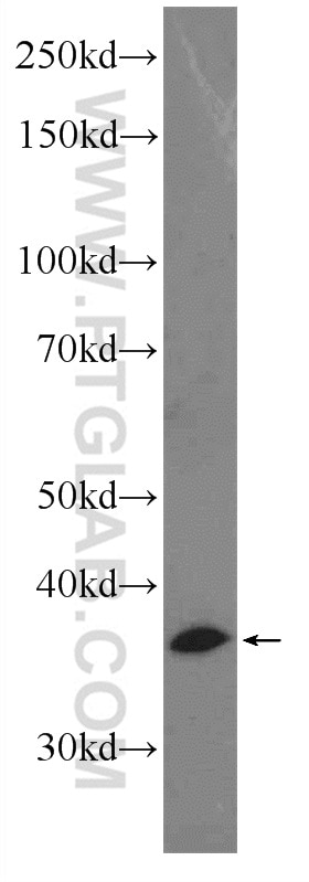 WB analysis of mouse brain using 12651-1-AP