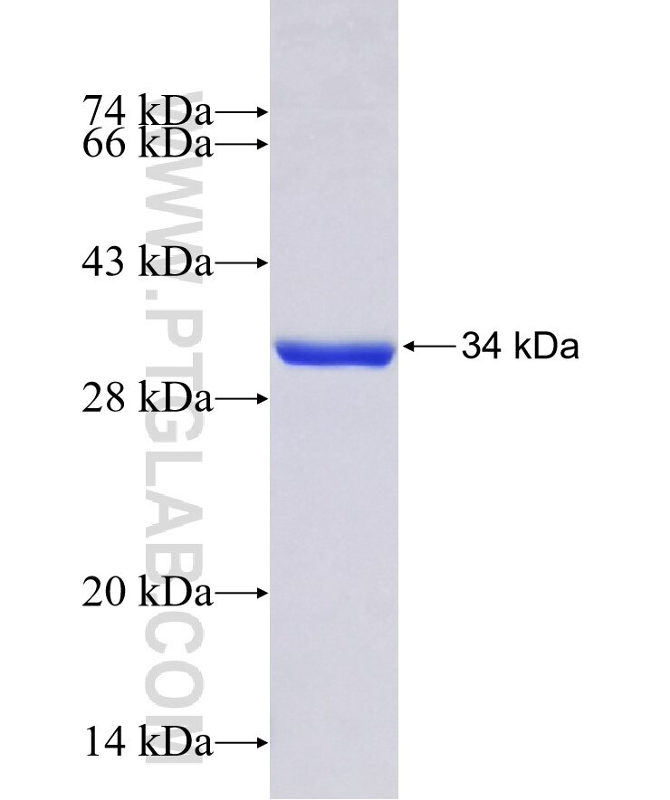 SIAH2 fusion protein Ag32820 SDS-PAGE