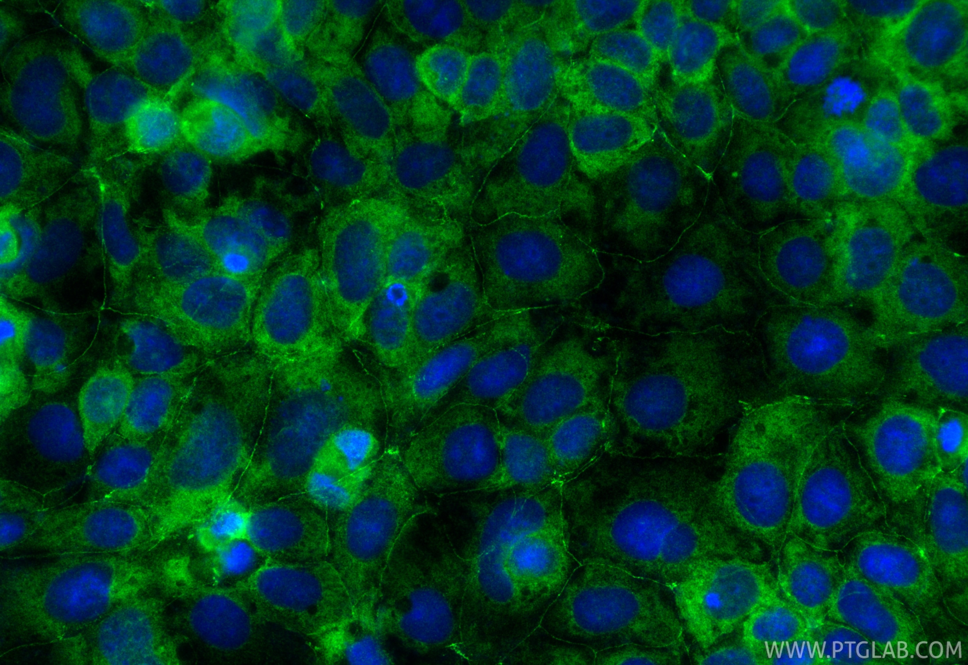IF Staining of Caco-2 using 55352-1-AP (same clone as 55352-1-PBS) Immunofluorescence (IF) / fluorescent staining of Caco-2 cells using SIDT1 Polyclonal antibody (55352-1-AP)