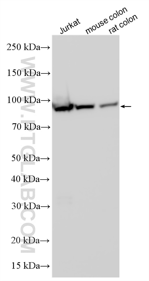 WB analysis using 55352-1-AP Western Blot (WB) analysis of various lysates using SIDT1 Polyclonal antibody (55352-1-AP)
