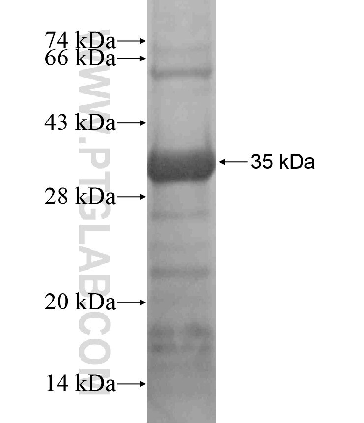SIDT2 fusion protein Ag17848 SDS-PAGE