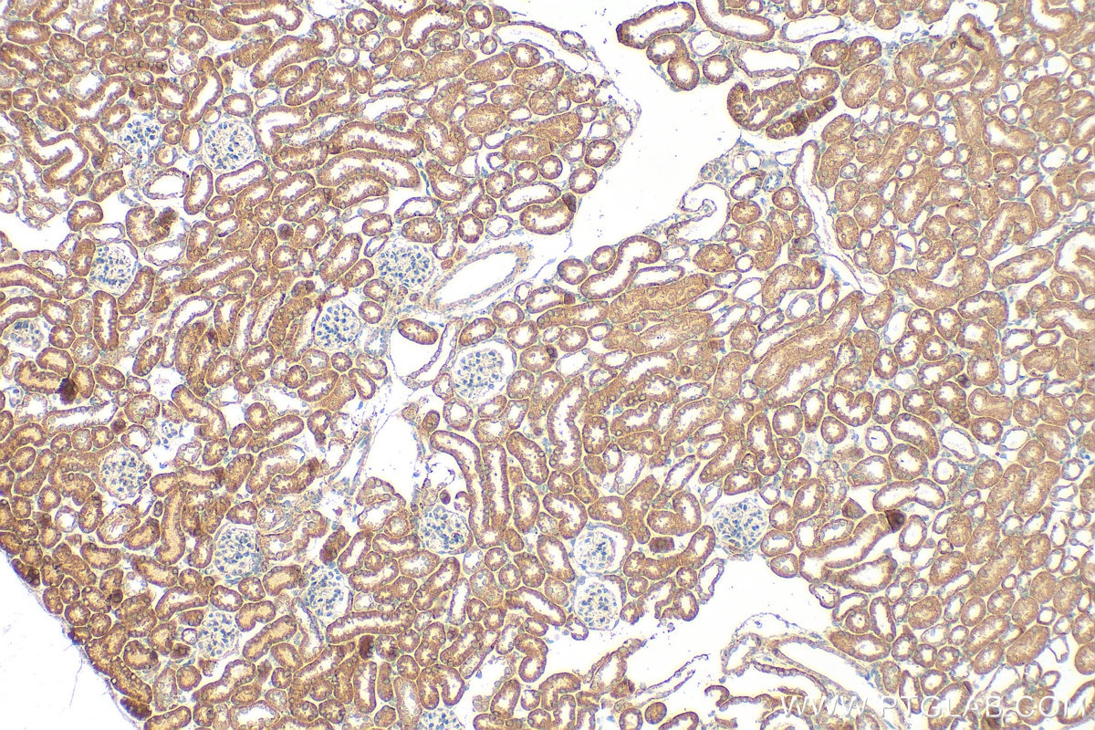 Immunohistochemistry (IHC) staining of mouse kidney tissue using SIGIRR Polyclonal antibody (27828-1-AP)
