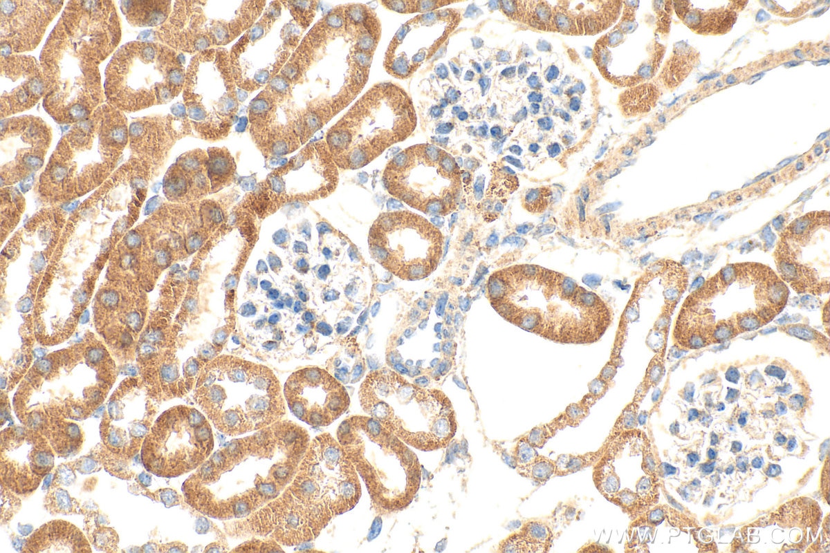 Immunohistochemistry (IHC) staining of mouse kidney tissue using SIGIRR Polyclonal antibody (27828-1-AP)