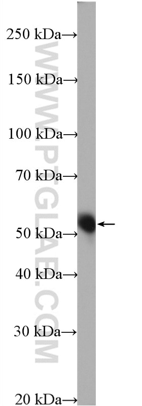 Western Blot (WB) analysis of mouse lung tissue using SIGIRR Polyclonal antibody (27828-1-AP)